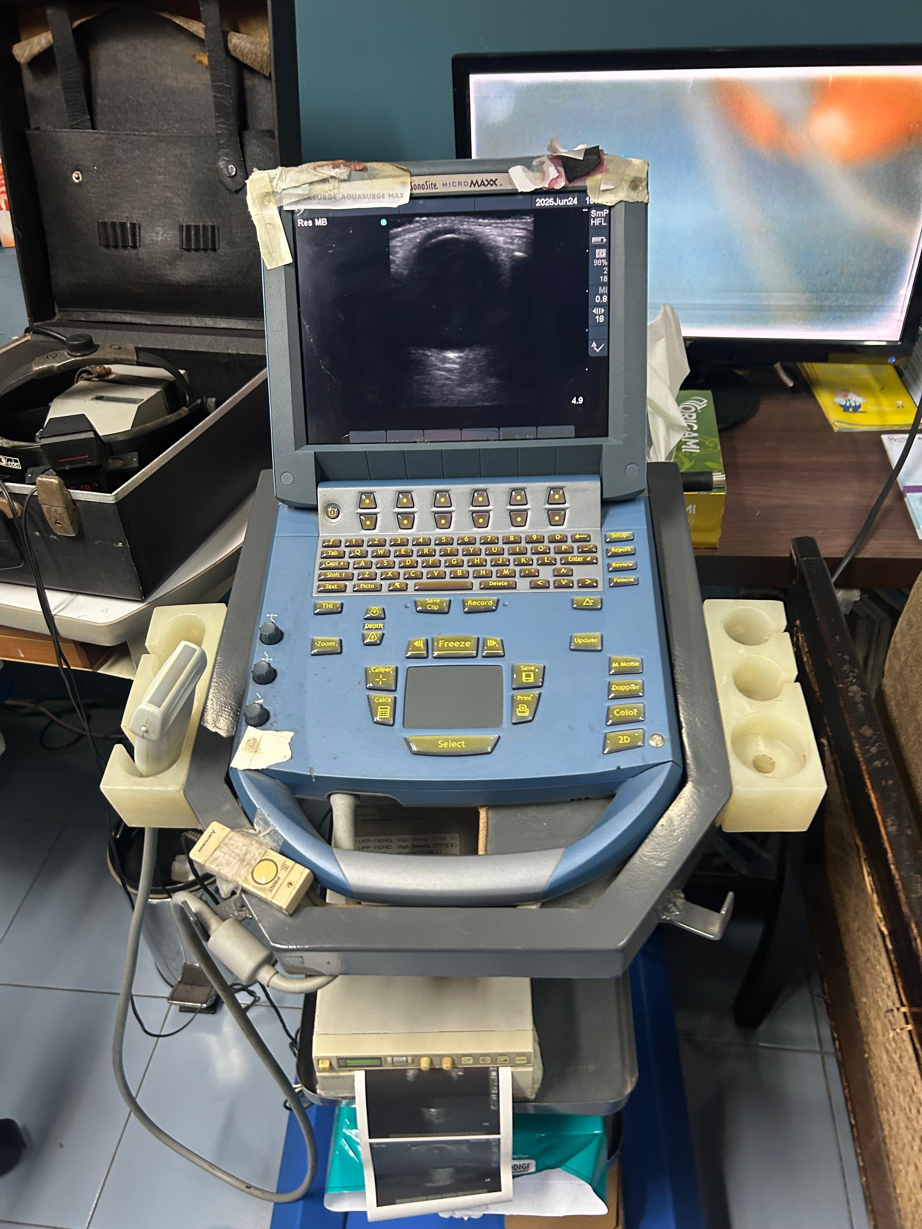 Sonosite Sonography System